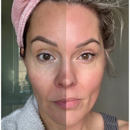 block image