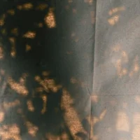 block image