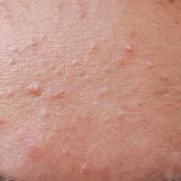 block image